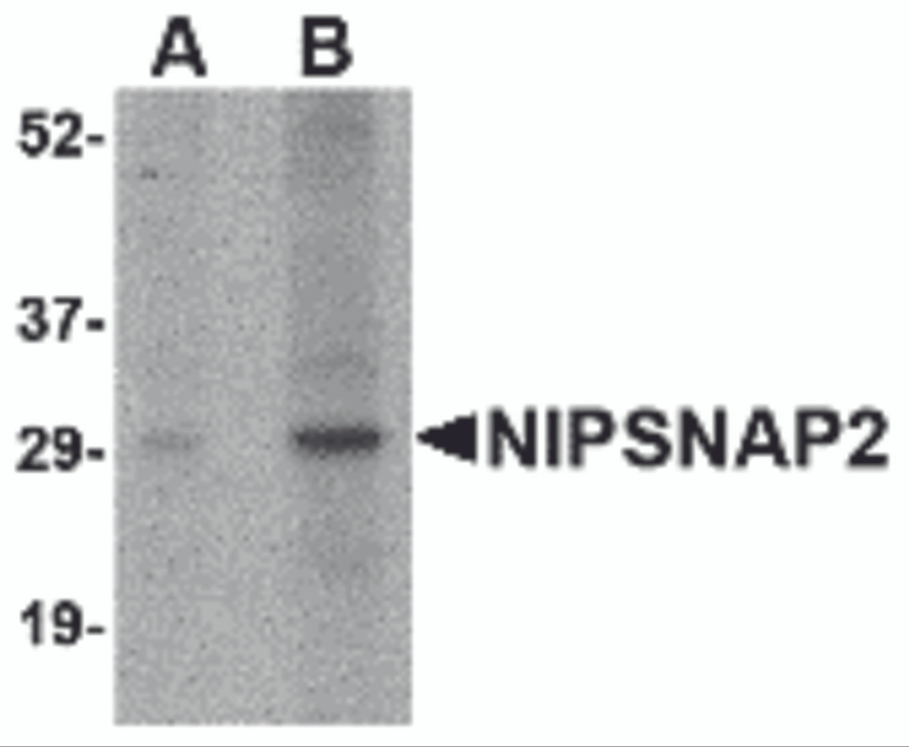 Western blot analysis of NIPSNAP2 in human skeletal muscle tissue lysate with NIPSNAP2 antibody at (A) 1 and (B) 2 &#956;g/mL.