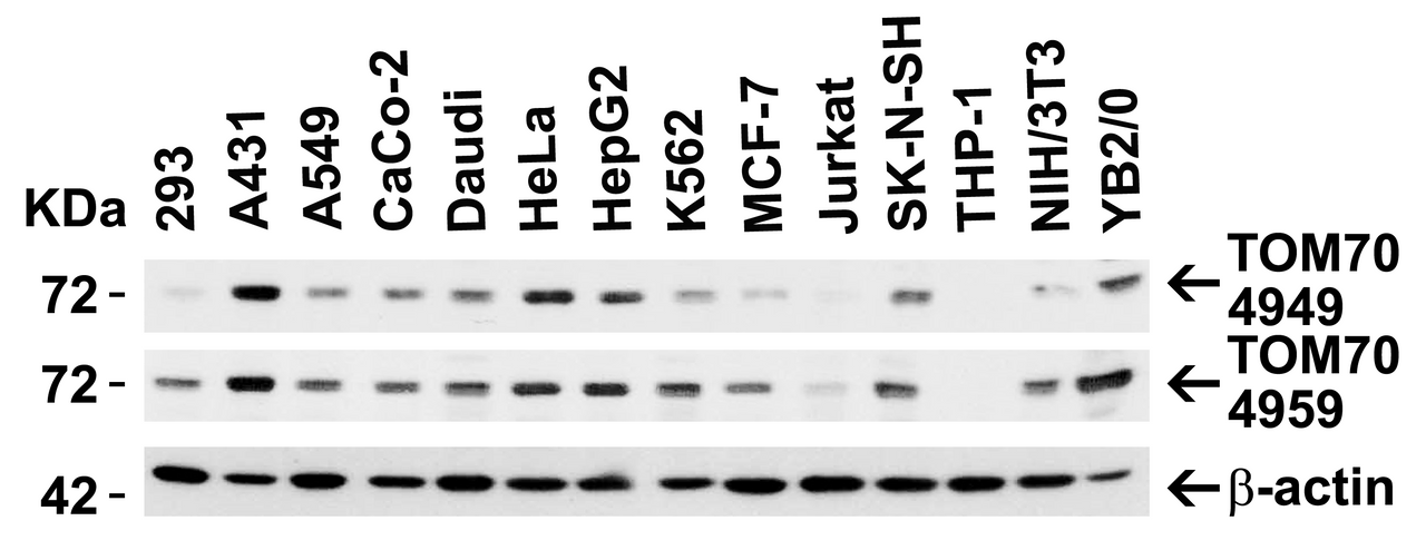 Figure 1 Independent Antibody Validation (IAV) via Protein Expression Profile in Human, Mouse and Rat Cell Lines
Loading: 15 &#956;g of lysates per lane.
Antibodies: TOM70 4949 (2 &#956;g/mL) , TOM70 4959 (2 &#956;g/mL) and beta-actin (1 &#956;g/mL) , 1h incubation at RT in 5% NFDM/TBST.
Secondary: Goat anti-rabbit IgG HRP conjugate at 1:10000 dilution.