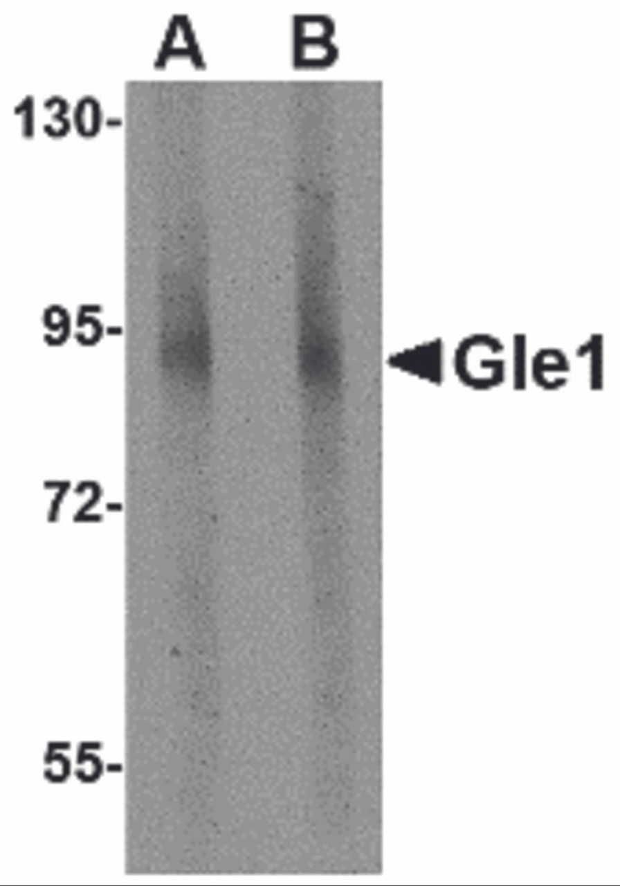 Western blot analysis of Gle1 in mouse brain tissue lysate with Gle1 antibody at (A) 1 and (B) 2 &#956;g/mL.