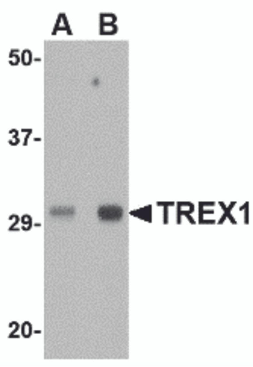 Western blot analysis of TREX1 in human spleen tissue lysate with TREX1 antibody at (A) 0.5 and (B) 1 &#956;g/mL.