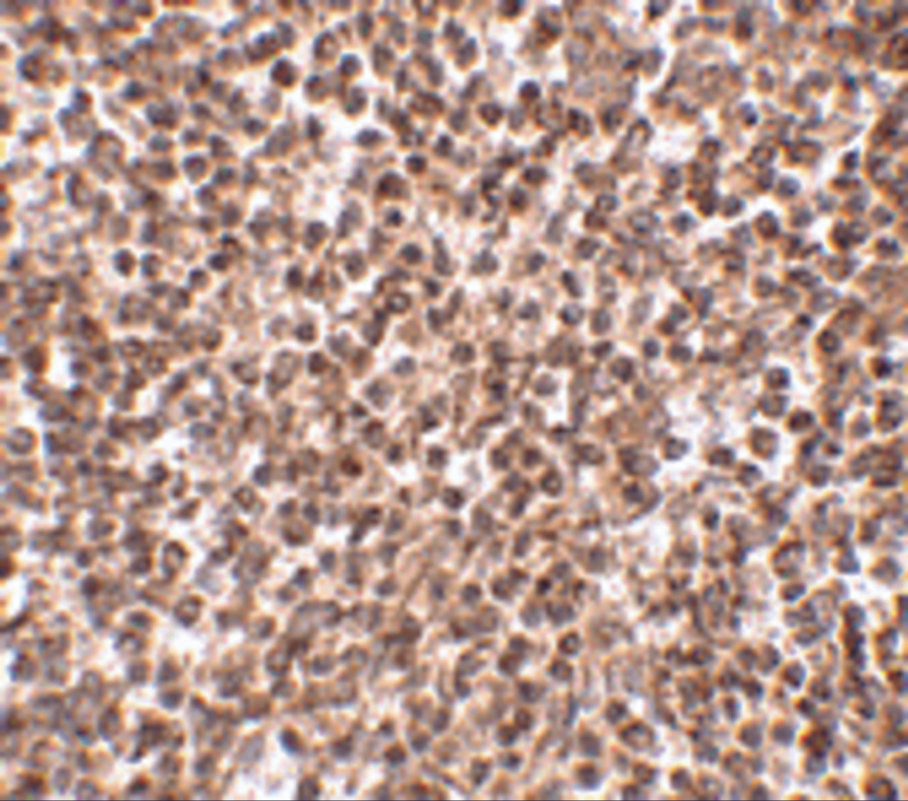 Immunohistochemistry of TREX1 in human spleen tissue with TREX1 antibody at 2.5 ug/mL.