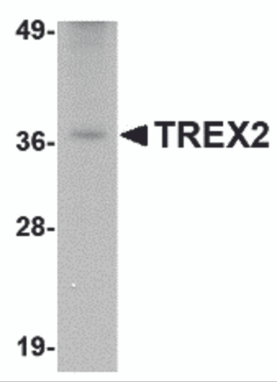 Western blot analysis of TREX2 in rat liver tissue lysate with TREX2 antibody at 2.5 &#956;g/mL.