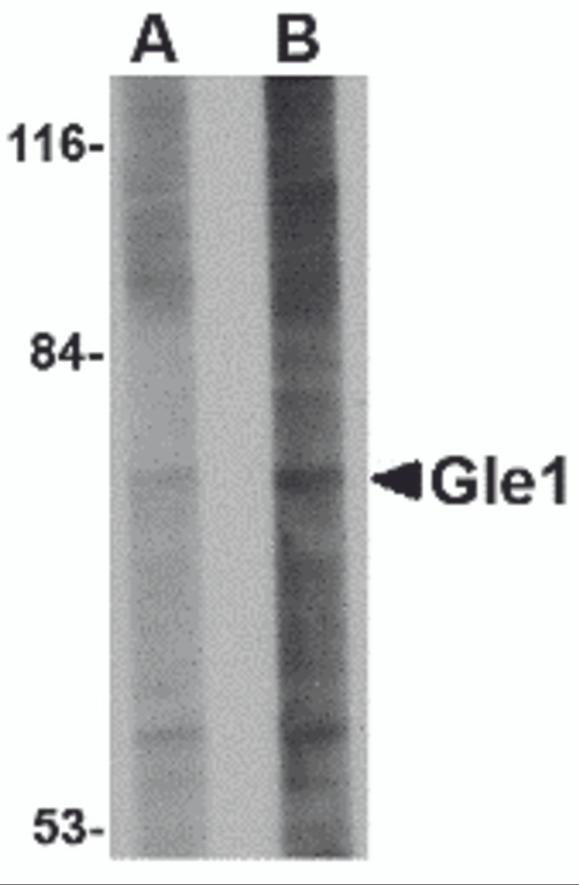 Western blot analysis of Gle1 in 293 cell lysate with Gle1 antibody at (A) 1 and (B) 2 &#956;g/mL.