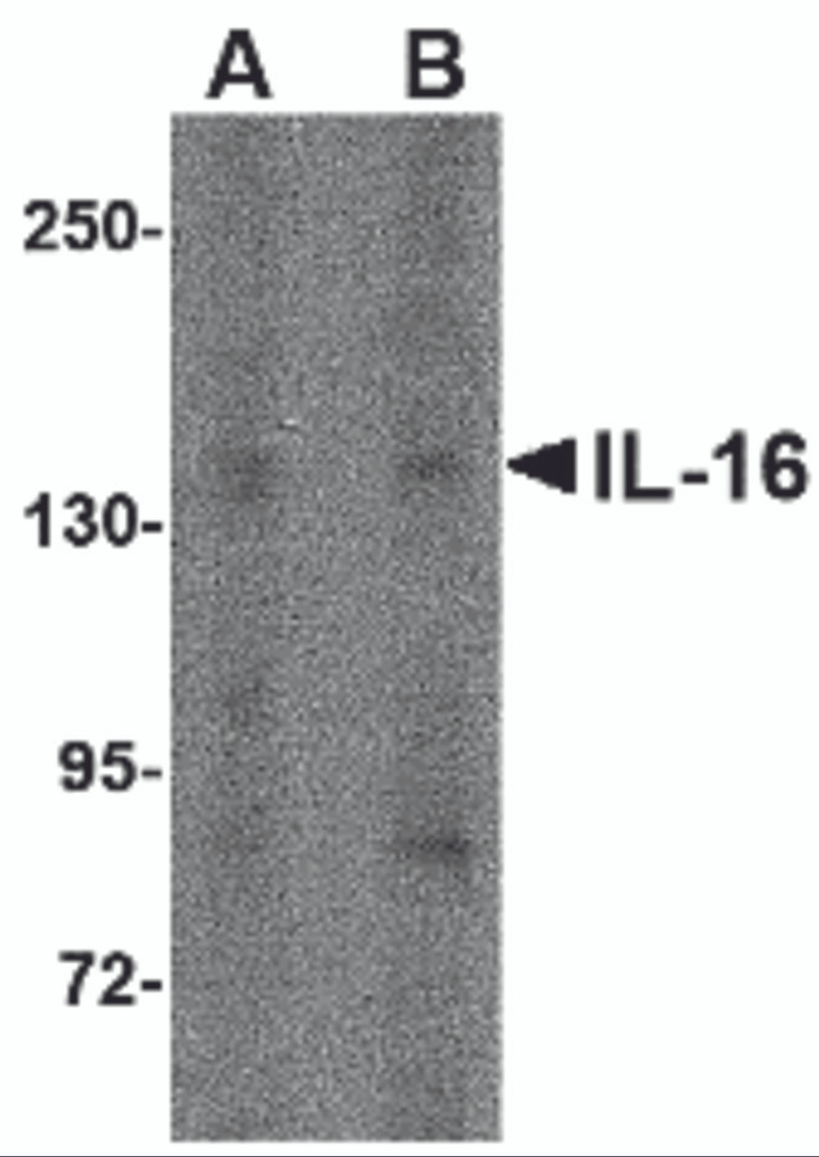 Western blot analysis of IL-16 in rat brain tissue lysate with IL-16 antibody at (A) 1 &#956;g/ml and (B) 2 &#956;g/mL.