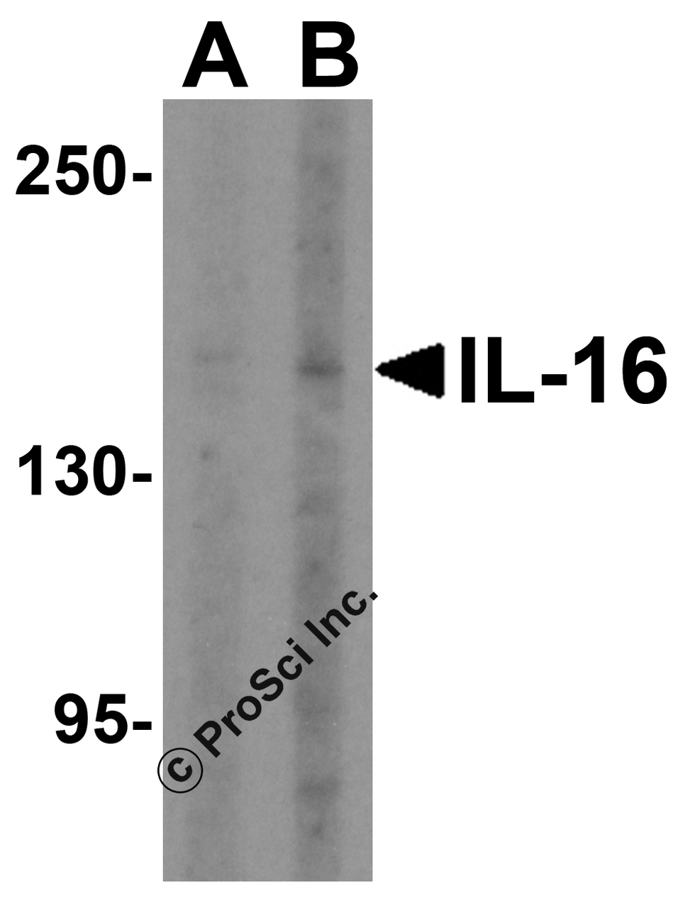 Western blot analysis of IL-16 in rat brain tissue lysate with IL-16 antibody at (A) 2.5 and (B) 5 &#956;g/mL.