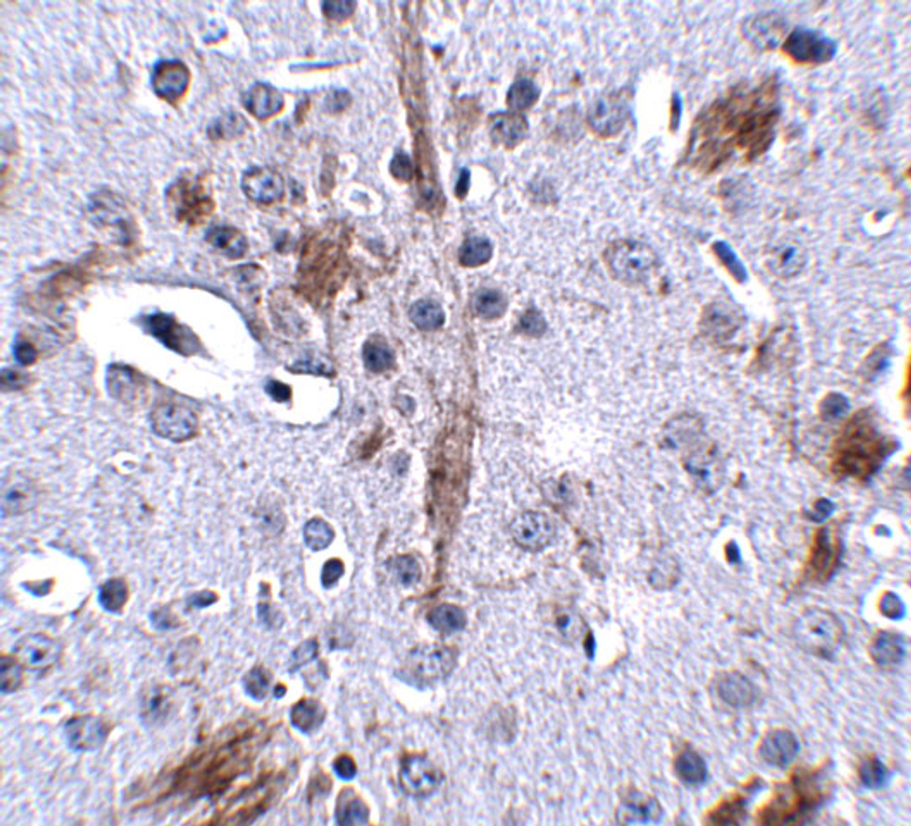 Immunohistochemistry of TTBK1 in mouse brain tissue with TTBK1 antibody at 2.5 ug/mL.