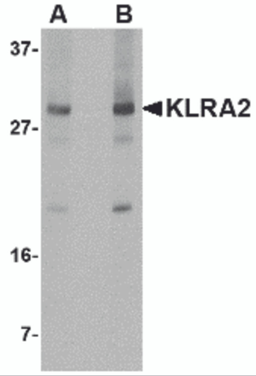 Western blot analysis of KLRA2 in mouse spleen tissue lysate with KLRA2 antibody at (A) 0.5 and (B) 1 &#956;g/mL.