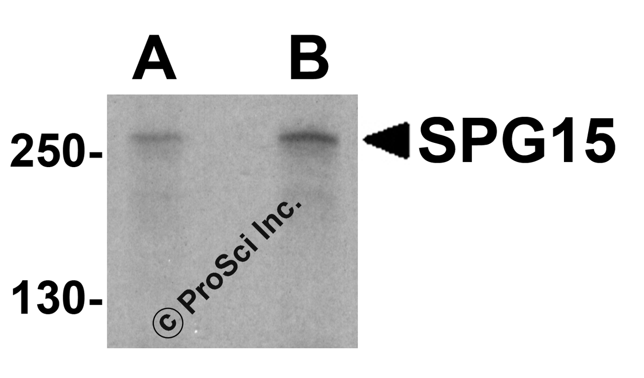 Western blot analysis of SPG15 in K562 cell lysate with SPG15 antibody at (A) 1 and (B) 2 &#956;g/mL.