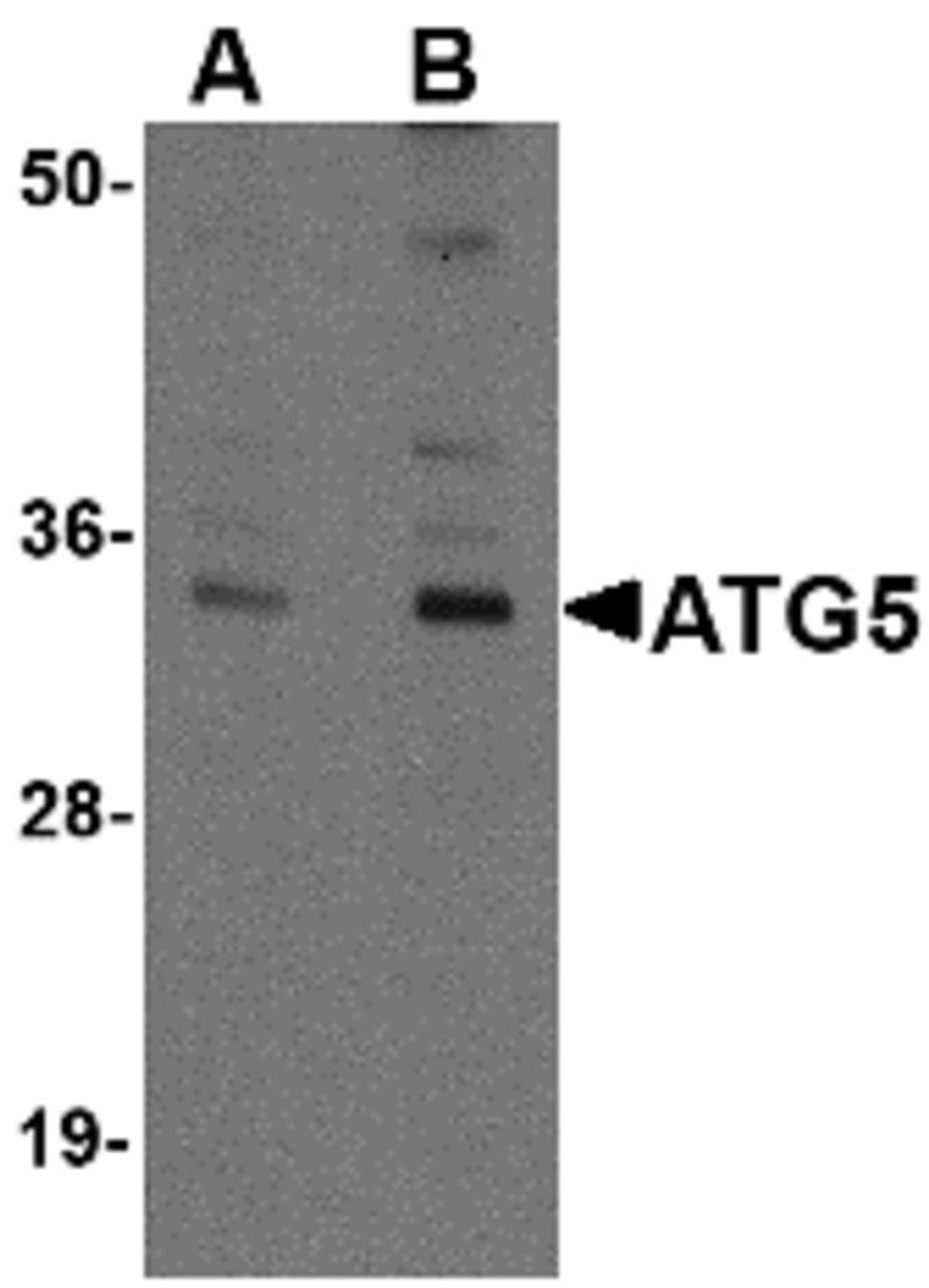 Figure 1 Western Blot Validation of ATG5 in Mouse Spleen 
Loading: 15 &#956;g of lysates per lane.
Antibodies: ATG5, 1h incubation at RT in 5% NFDM/TBST.
Secondary: Goat anti-chicken IgG HRP conjugate at 1:10000 dilution.
Lane A: 1 &#956;g/mL
Lane B: 2 &#956;g/mL