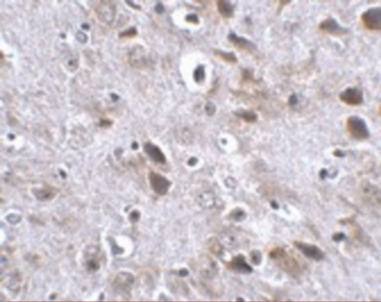 Immunohistochemistry of TMEM18 in mouse brain tissue with TMEM18 antibody at 2.5 ug/mL.