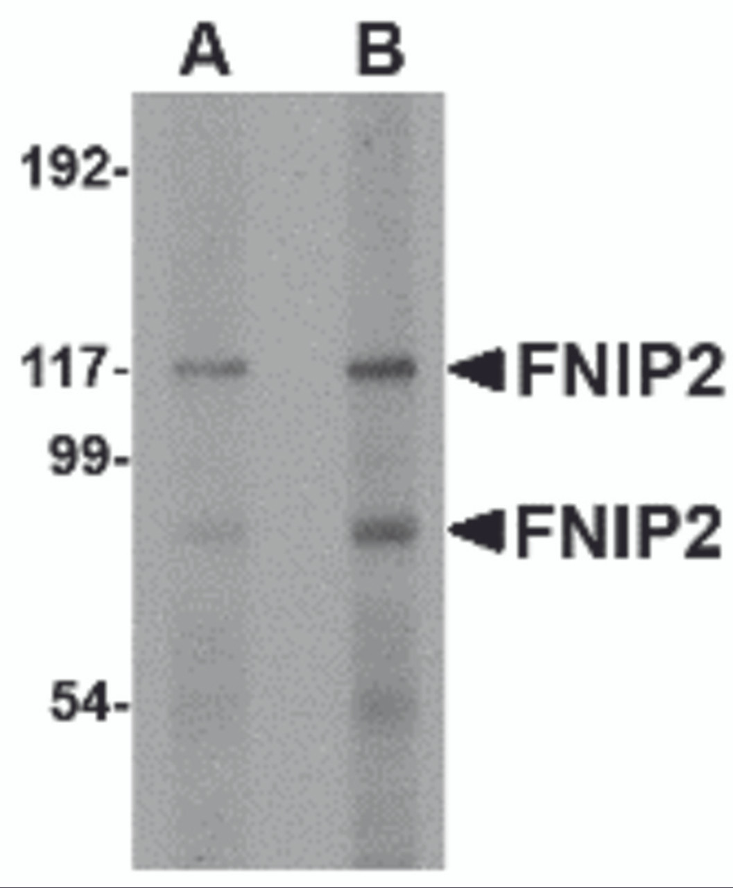 Western blot analysis of FNIP2 in rat skeletal muscle lysate with FNIP2 antibody at (A) 1 and (B) 2 &#956;g/mL.