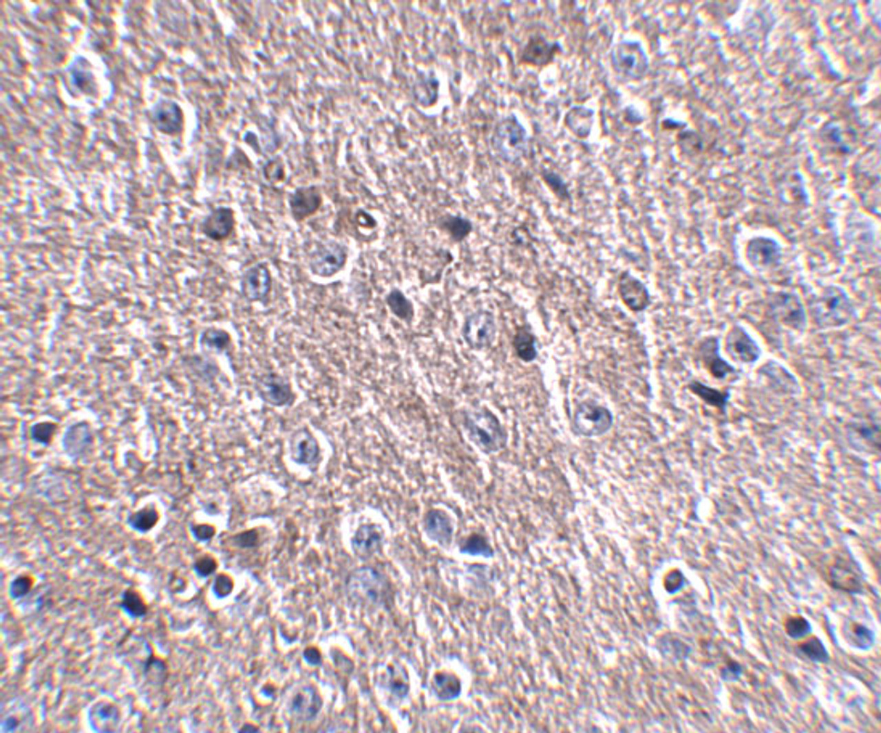 Immunohistochemistry of FNIP2 in mouse brain tissue with FNIP2 antibody at 2.5 ug/mL.