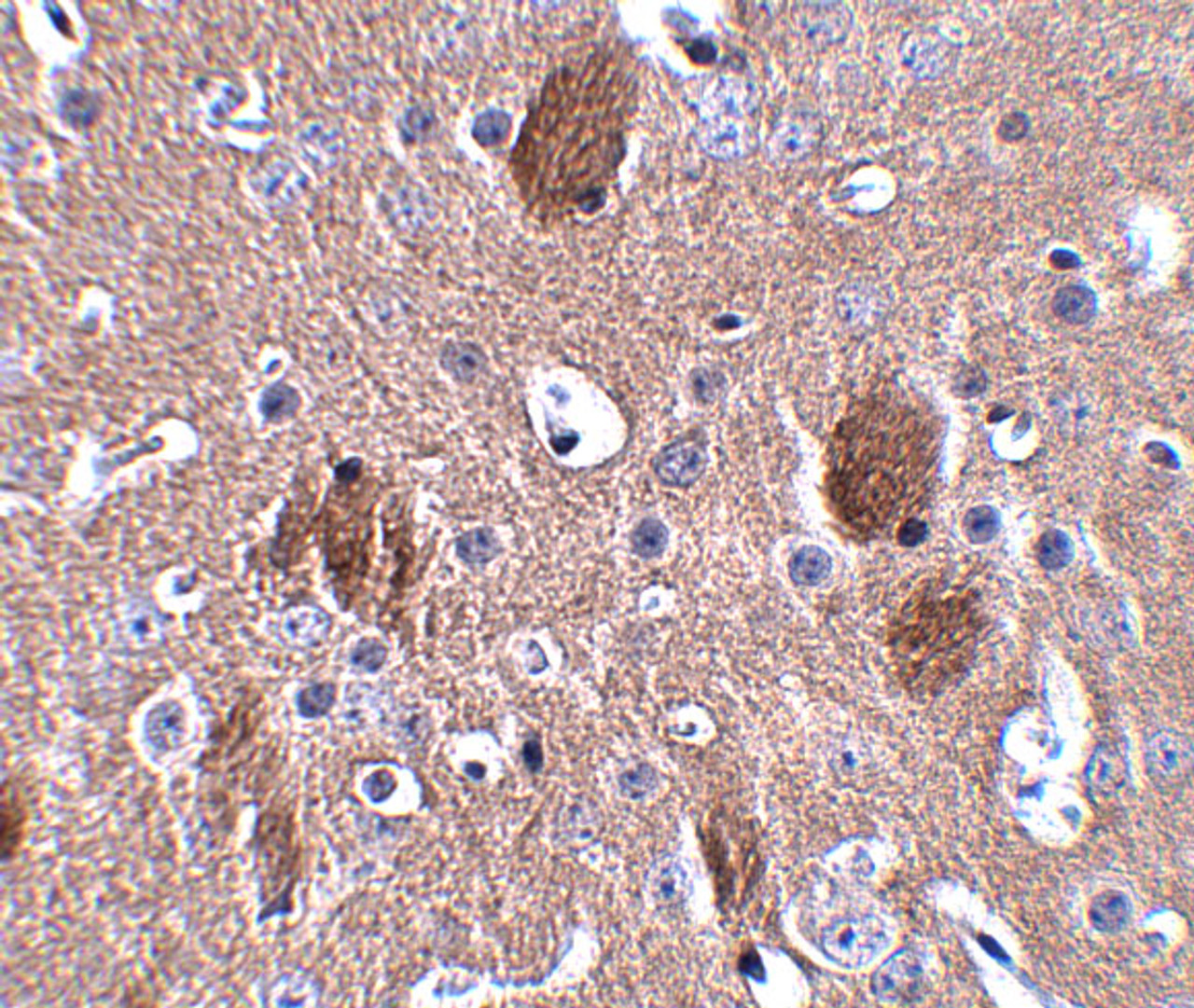 Immunohistochemistry of CDIP in mouse brain tissue with CDIP antibody at 2.5 ug/mL.