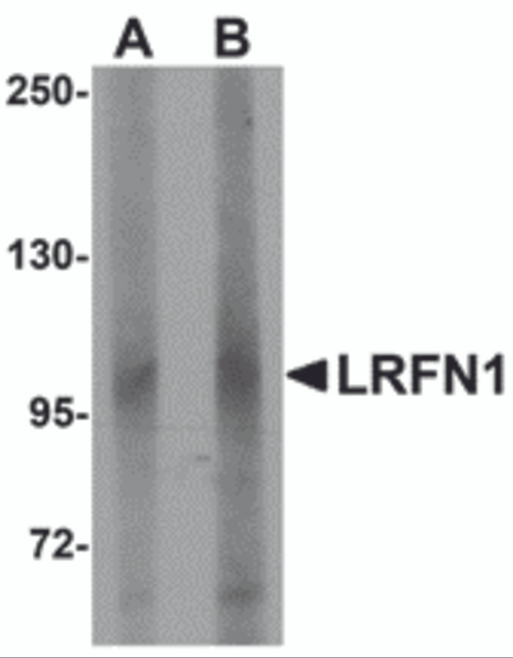 Western blot analysis of LRFN1 in human brain lysate with LRFN1 antibody at (A) 1 and (B) 2 &#956;g/mL.