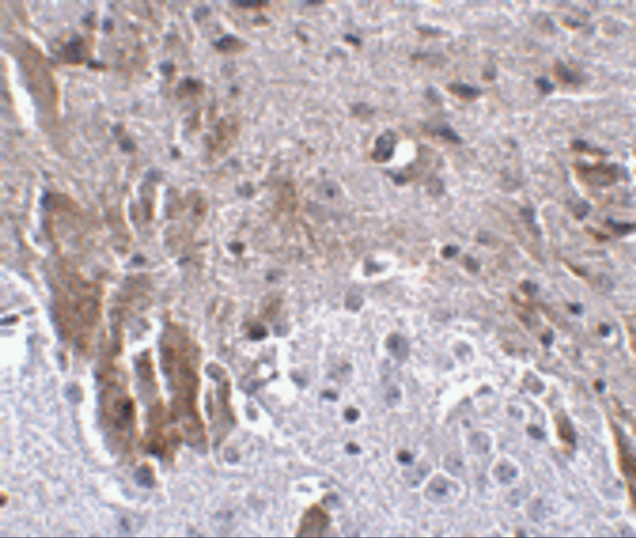 Immunohistochemistry of LRFN1 in mouse brain tissue with LRFN1 antibody at 2.5 ug/mL.
