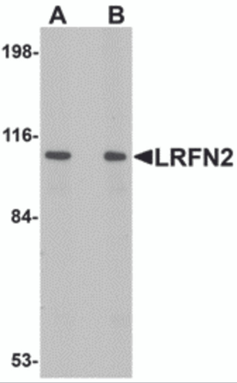 Western blot analysis of LRFN2 in rat brain lysate with LRFN2 antibody at (A) 1 and (B) 2 &#956;g/mL.