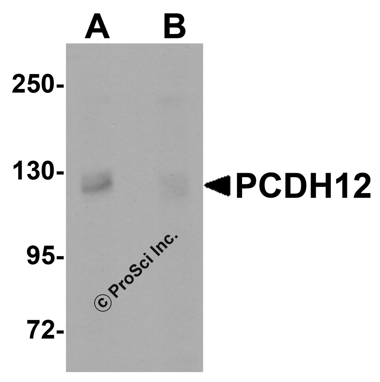 Western blot analysis of PCDH12 in K562 cell lysate with PCDH12 antibody at 1 &#956;g/mL in (A) the absence and (B) the presence of blocking peptide.