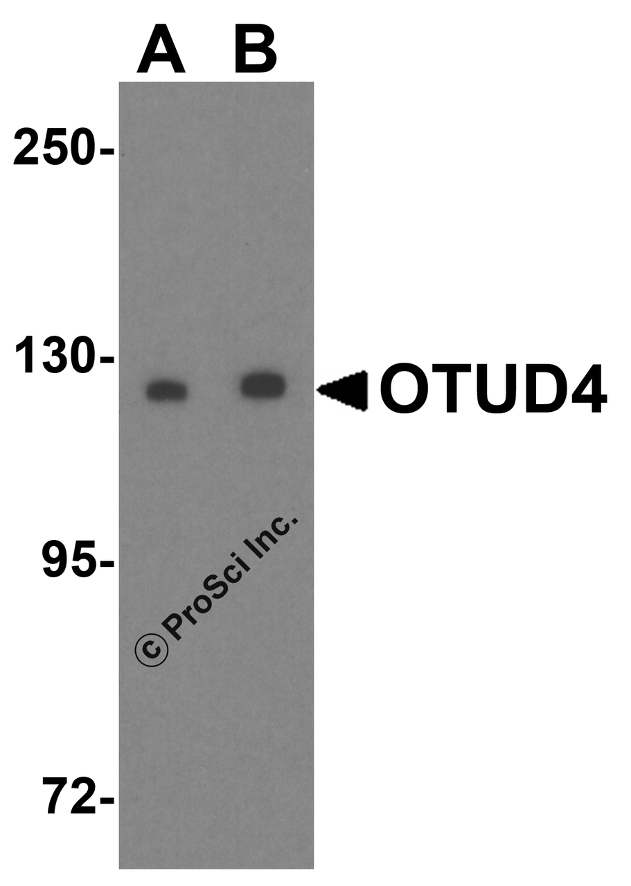 Western blot analysis of OTUD4 in Daudi cell lysate with OTUD4 antibody at (A) 0.25 and (B) 0.5 &#956;g/mL.