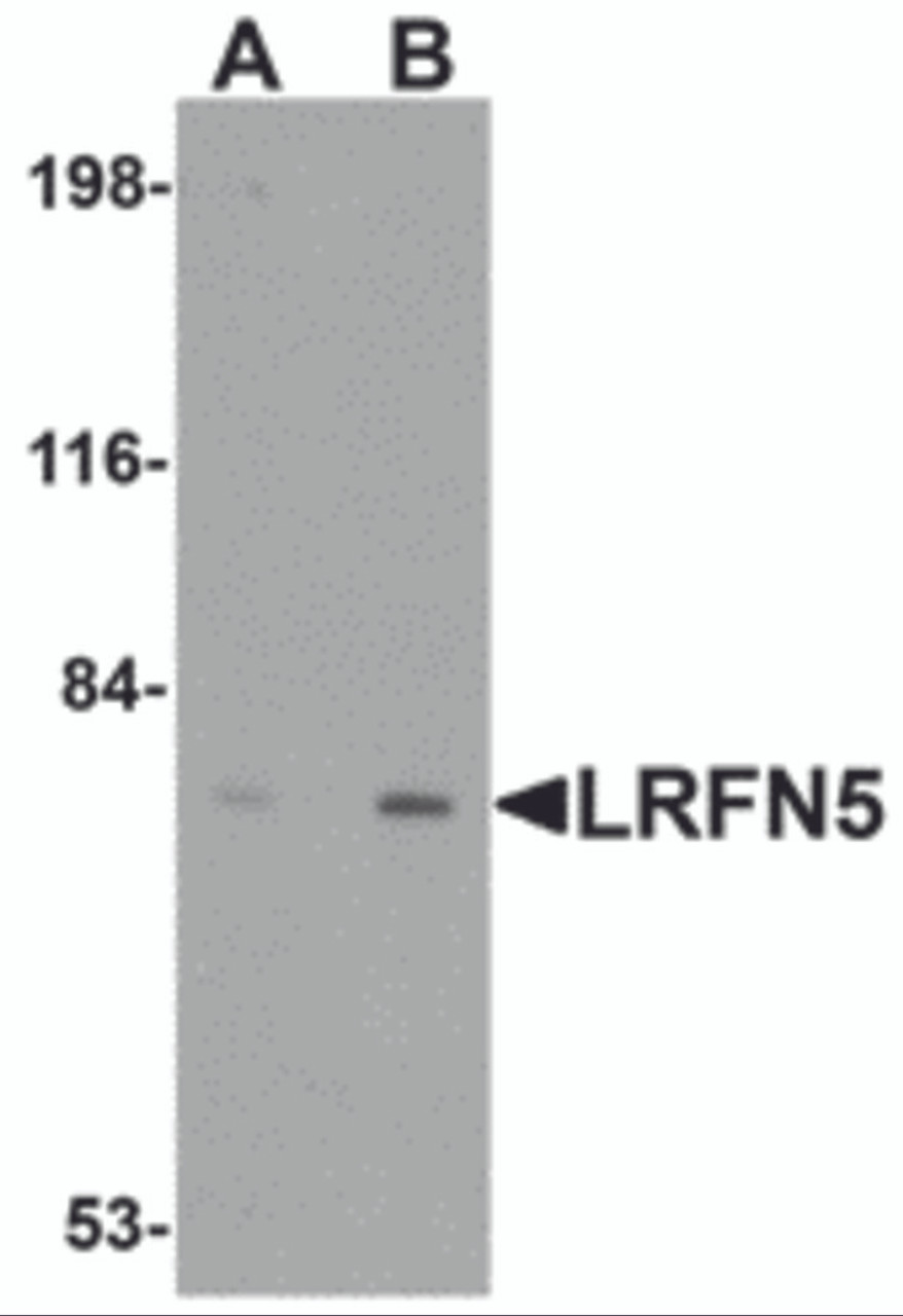 Western blot analysis of LRFN5 in EL4 cell lysate with LRFN5 antibody at (A) 0.5 and (B) 1 &#956;g/mL.
