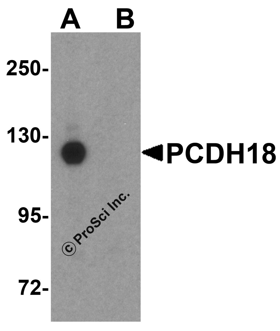 Western blot analysis of PCDH18 in HepG2 cell lysate with PCDH18 antibody at 1 &#956;g/mL in (A) the absence and (B) the presence of blocking peptide.