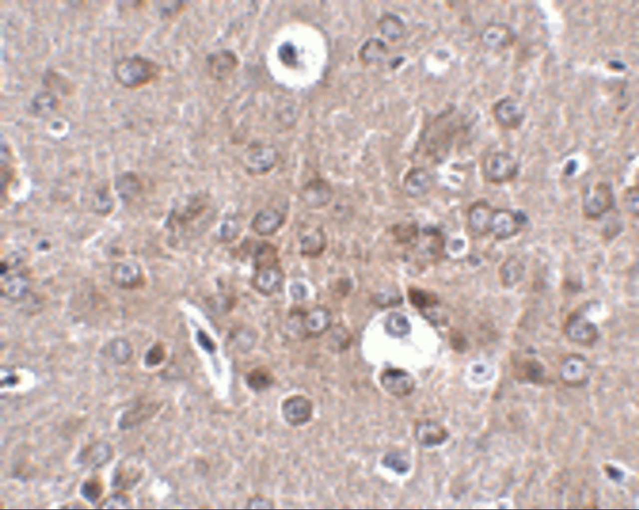 Immunohistochemistry of PCDH18 in mouse brain tissue with PCDH18 antibody at 2.5 ug/mL.