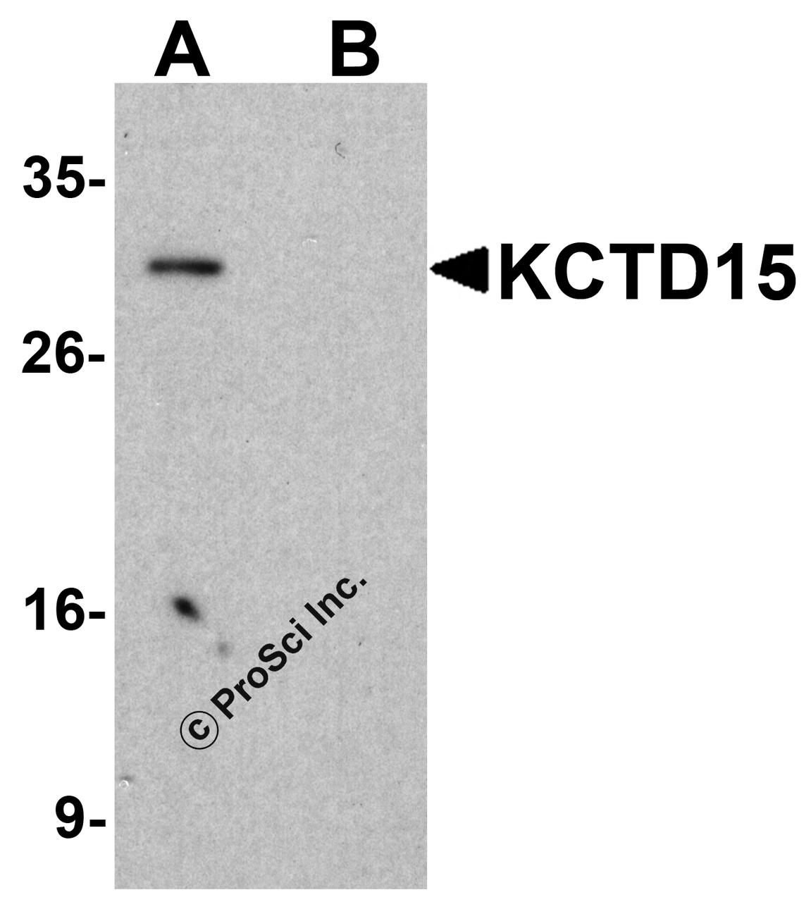 Western blot analysis of KCTD15 in HeLa cell lysate with KCTD15 antibody at 1&#956;g/ml in (A) the absence and (B) the presence of blocking buffer.