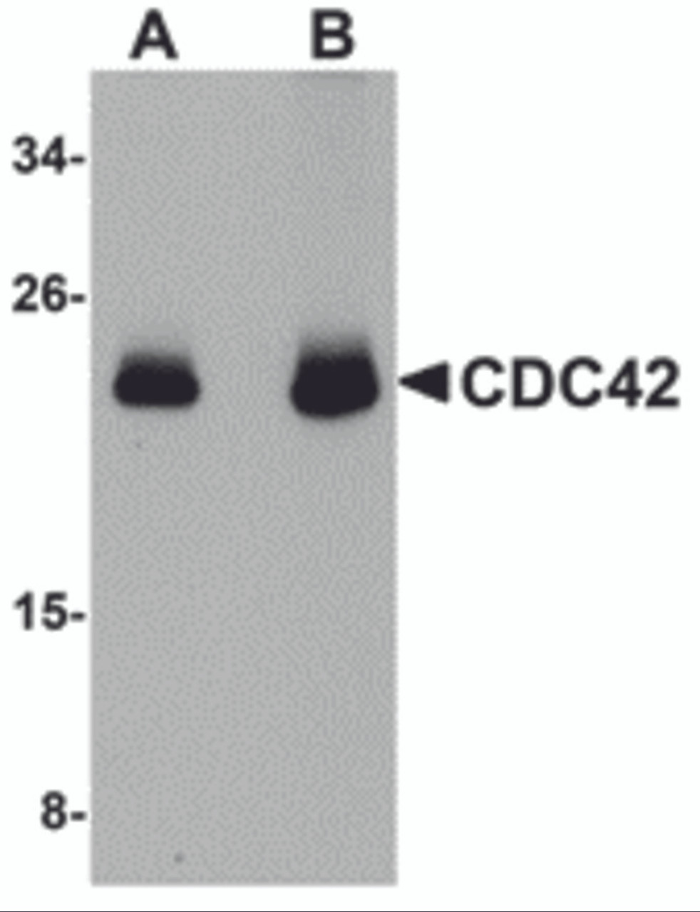 Western blot analysis of CDC42 in human brain tissue lysate with CDC42 antibody at (A) 0.5 and (B) 1 &#956;g/mL.