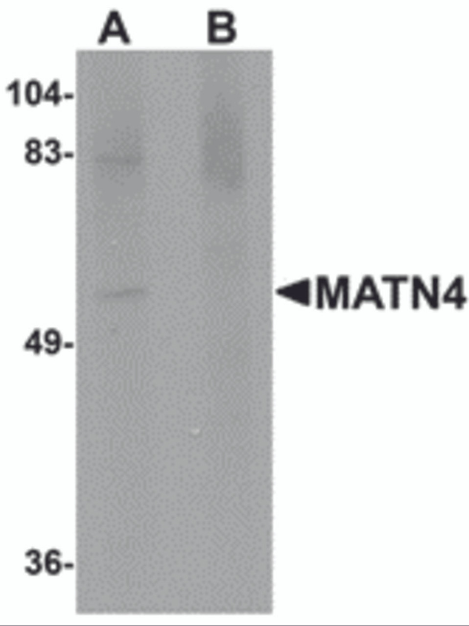 Western blot analysis of MATN4 in rat brain tissue lysate with MATN4 antibody at 1 &#956;g/mL in (A) the absence and (B) the presence of blocking peptide.