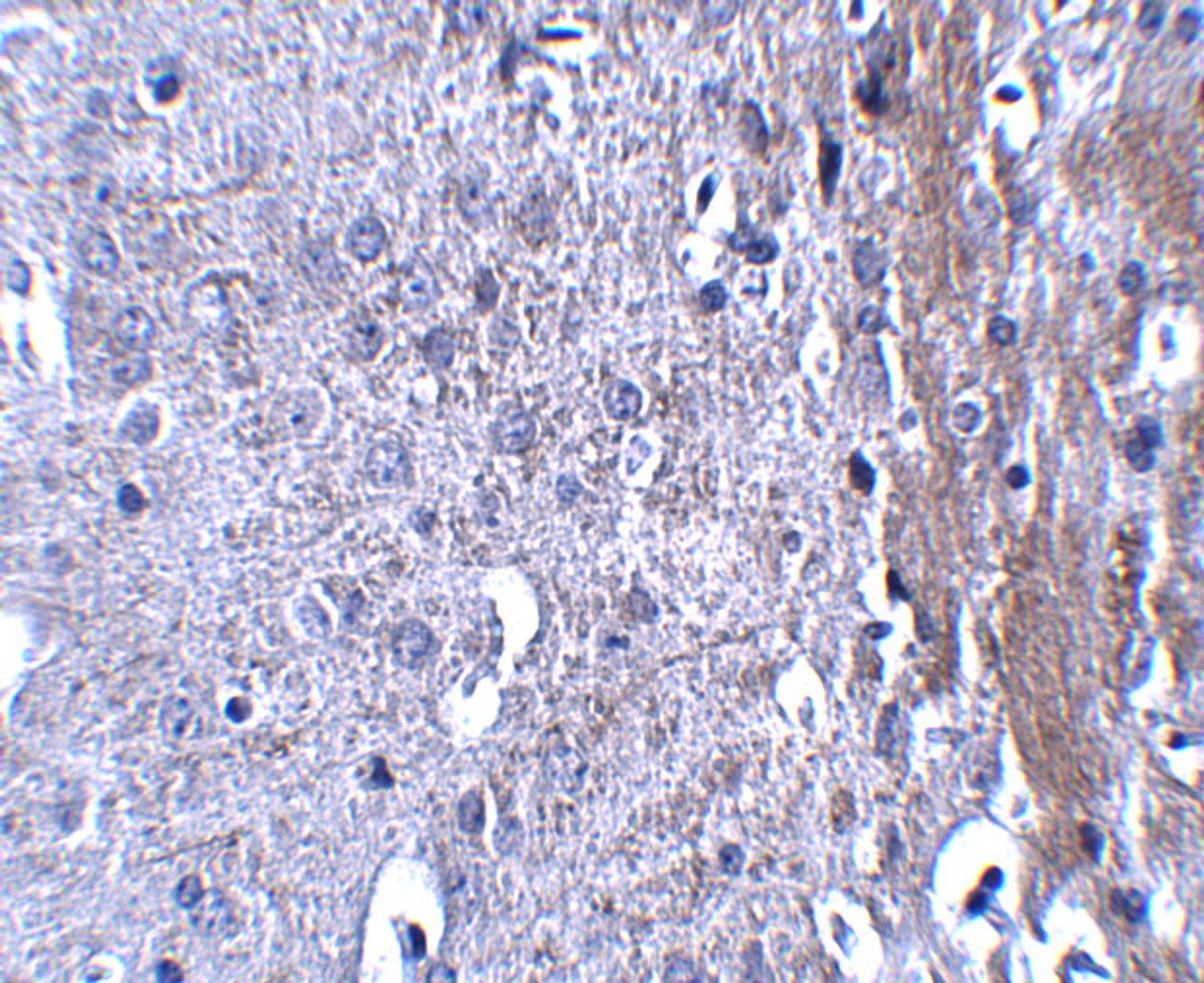 Immunohistochemistry of MATN4 in mouse brain tissue with MATN4 antibody at 2.5 ug/mL.