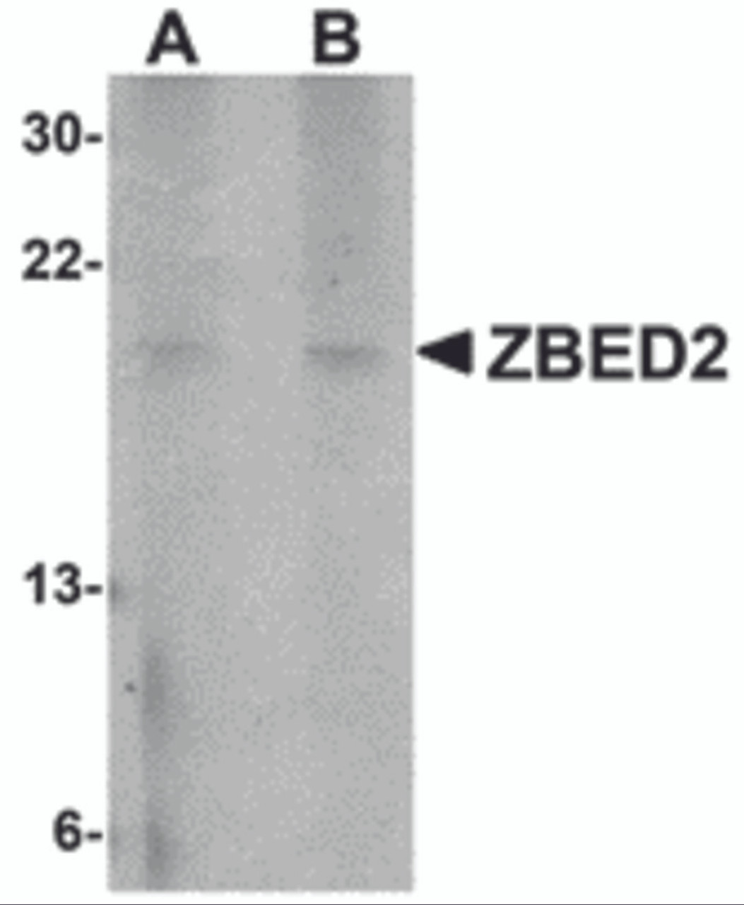 Western blot analysis of ZBED2 in A549 cell lysate with ZBED2 antibody at (A) 1 and (B) 2 &#956;g/mL.