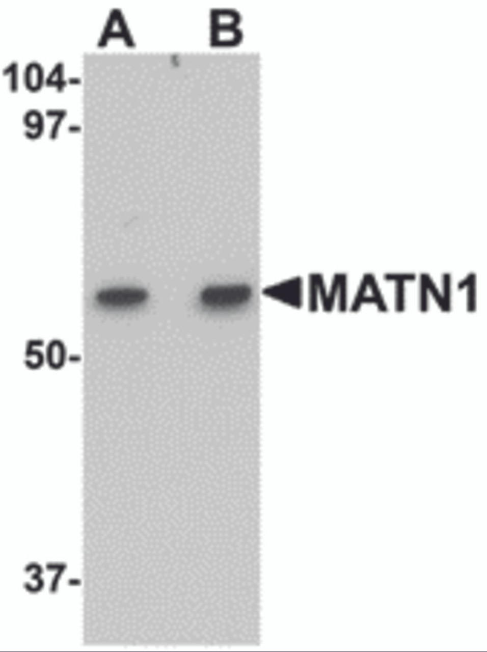 Western blot analysis of MATN1 in rat liver tissue lysate with MATN1 antibody at (A) 1 and (B) 2 &#956;g/mL.