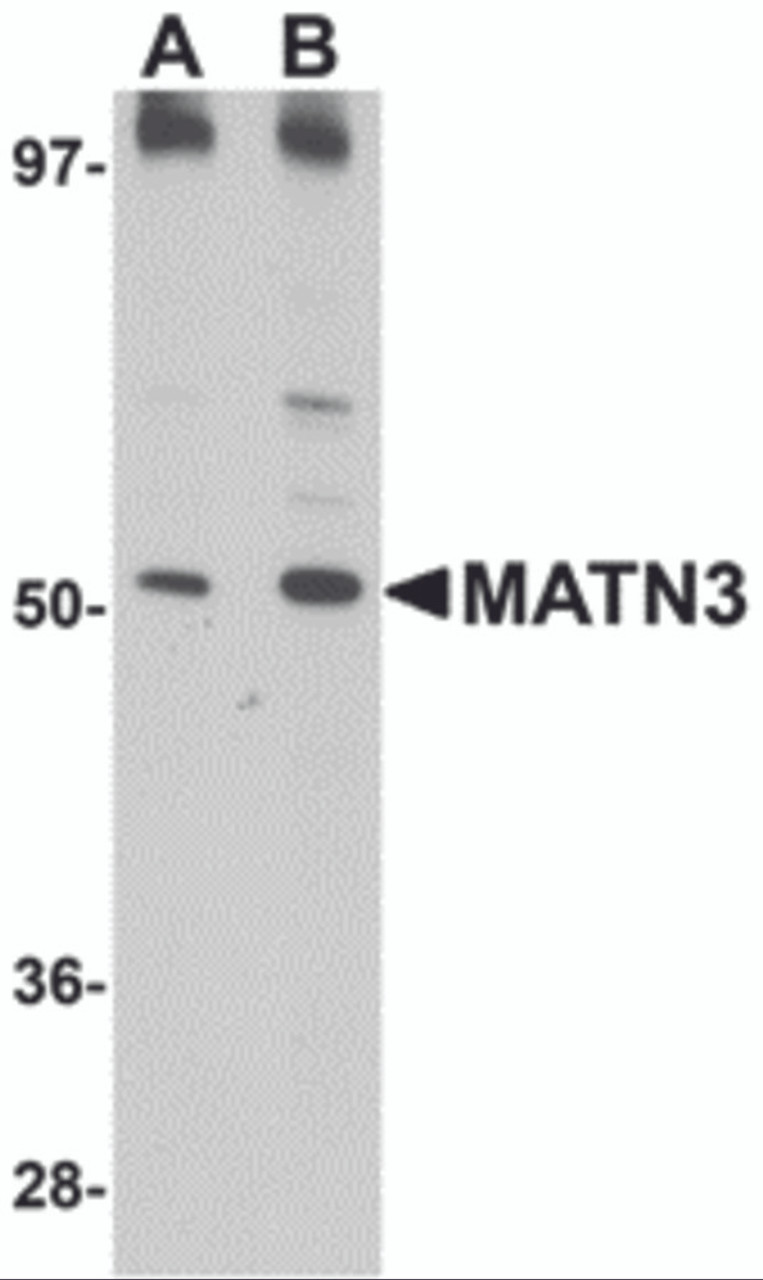 Western blot analysis of MATN3 in 3T3 cell lysate with MATN3 antibody at (A) 1 and (B) 2 &#956;g/mL.