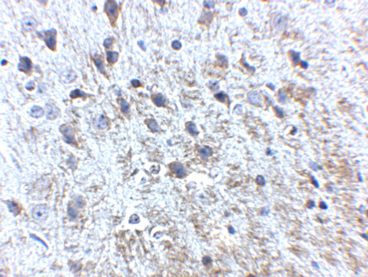 Immunohistochemistry of APP in mouse brain tissue with APP antibody at 2.5 ug/mL.