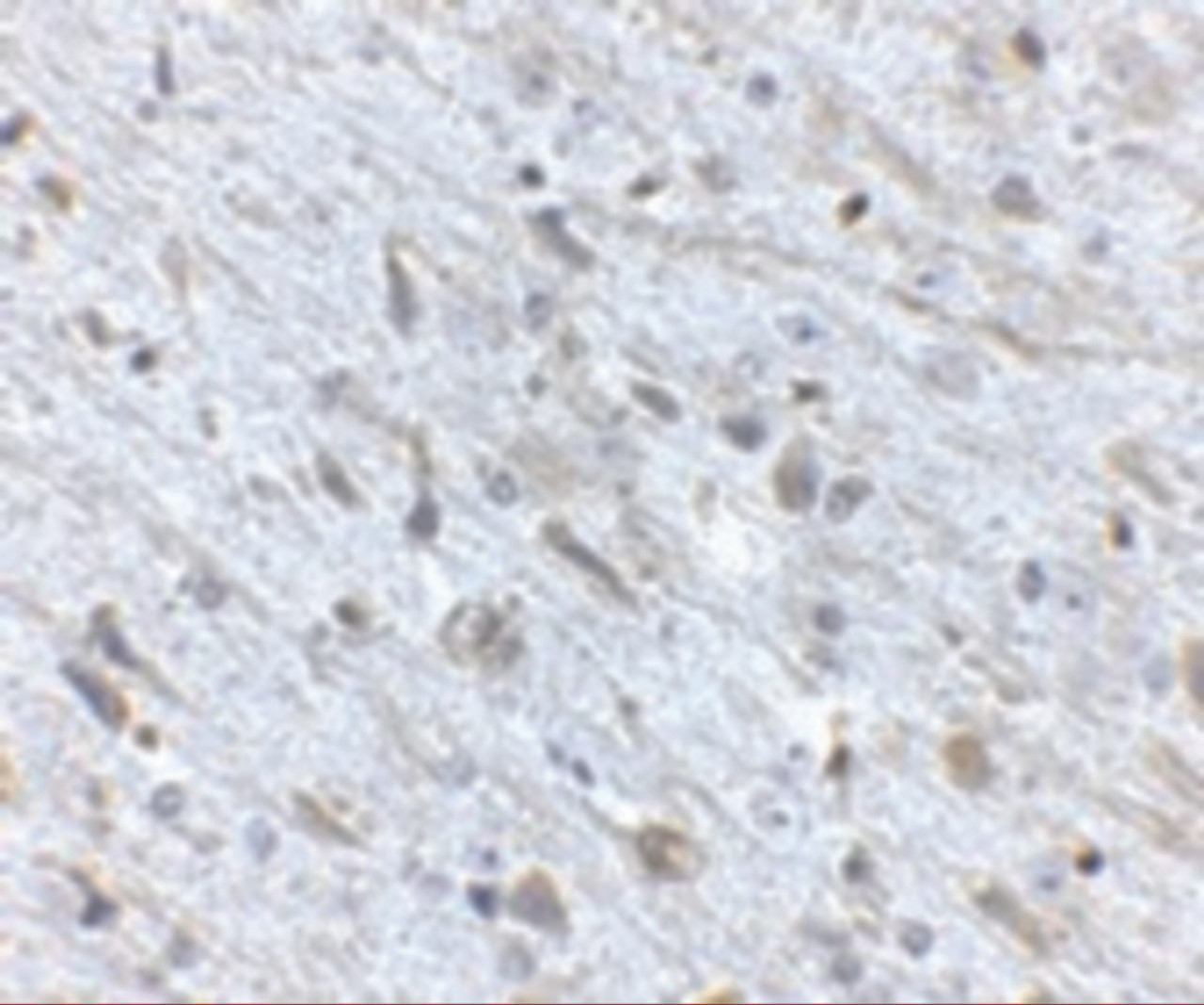 Immunohistochemistry of FKBP15 in mouse brain tissue with FKBP15 antibody at 2.5 ug/mL.