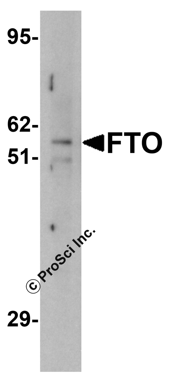 Western blot analysis of FTO in human uterus tissue lysate with FTO antibody at (A) 1 and (B) 2 &#956;g/mL.