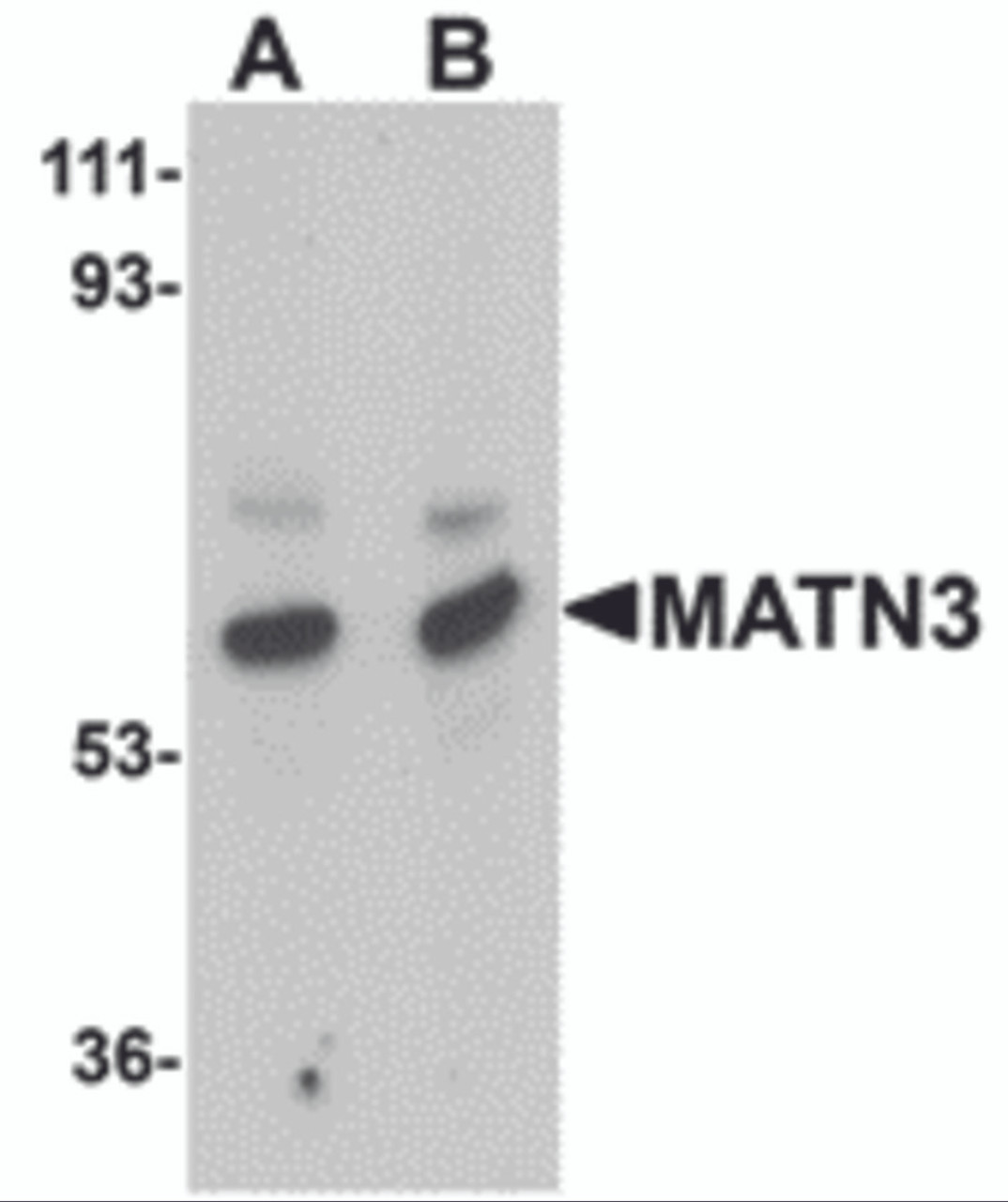 Western blot analysis of MATN3 in rat thymus tissue lysate with MATN3 antibody at (A) 1 and (B) 2 &#956;g/mL.