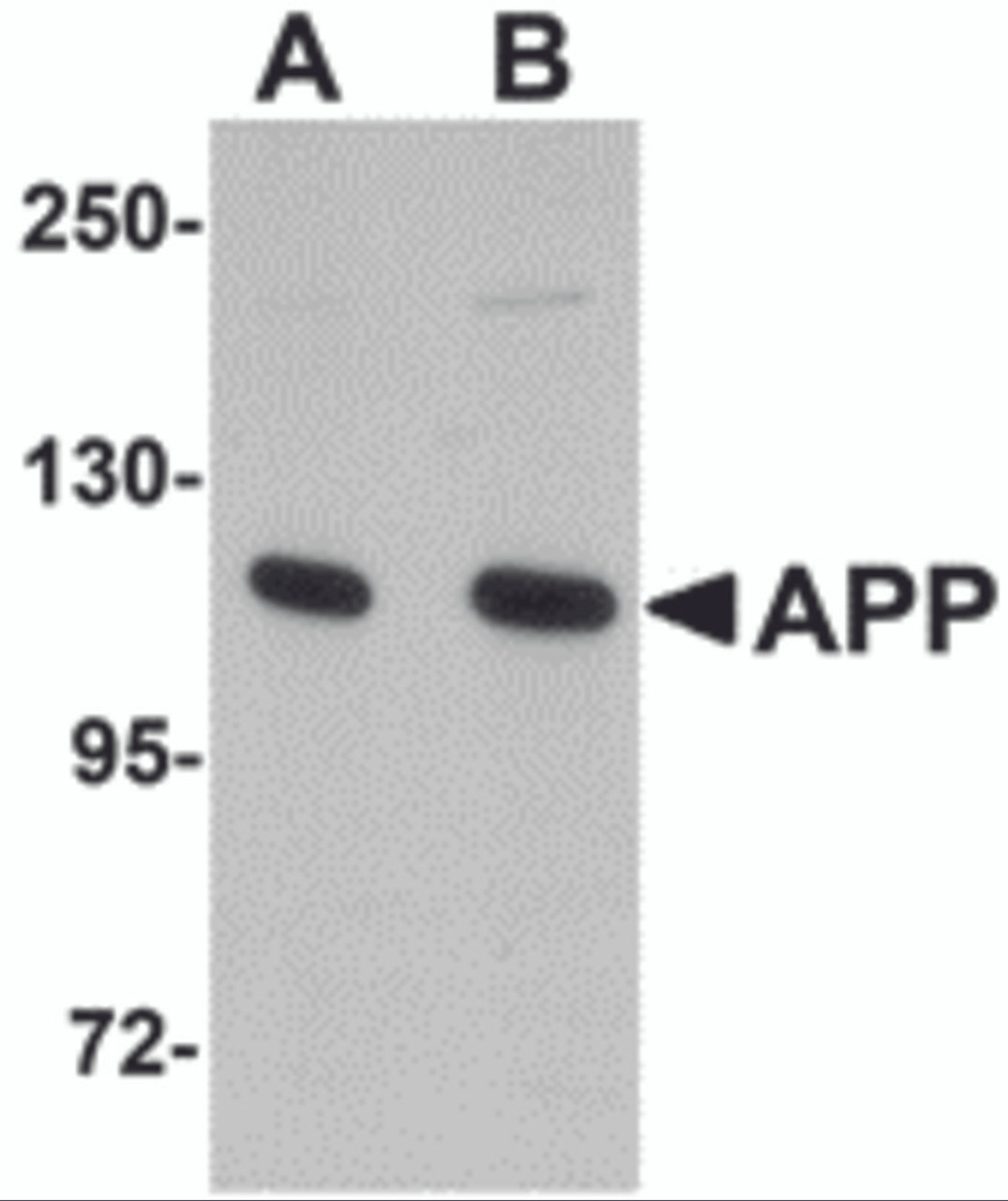 Western blot analysis of APP in rat brain tissue lysate with APP antibody at (A) 1 and (B) 2 &#956;g/mL.