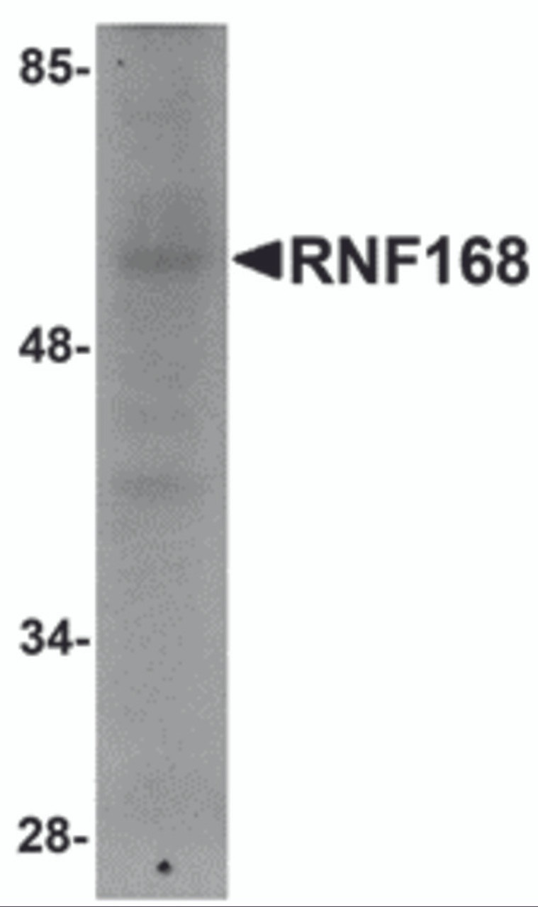 Western blot analysis of RNF168 in human brain tissue lysate with RNF168 antibody at 1 &#956;g/mL.