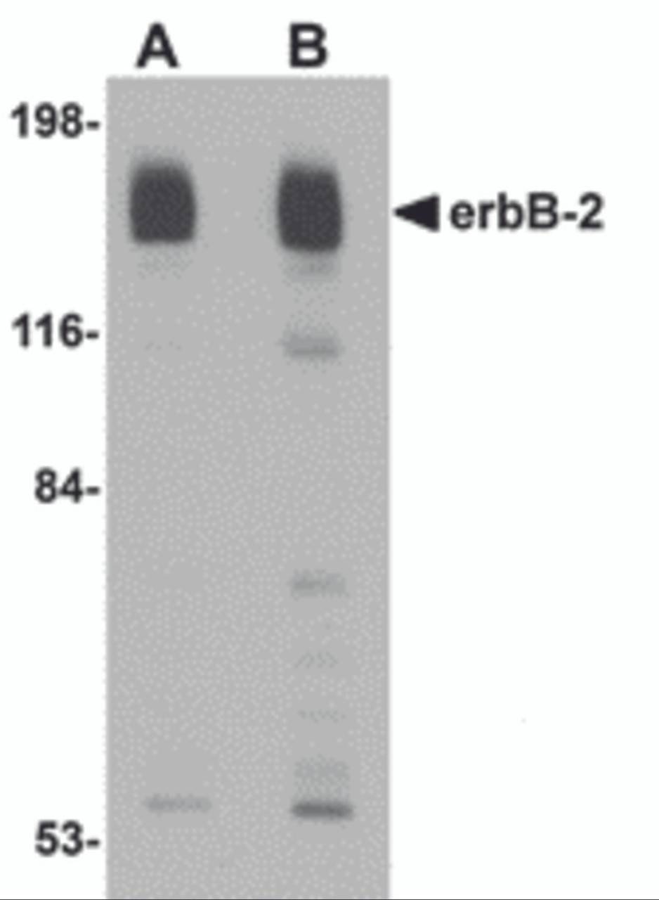 Western blot analysis of erbB-2 in rat liver tissue lysate with erbB-2 antibody at (A) 1 and (B) 2 &#956;g/mL.