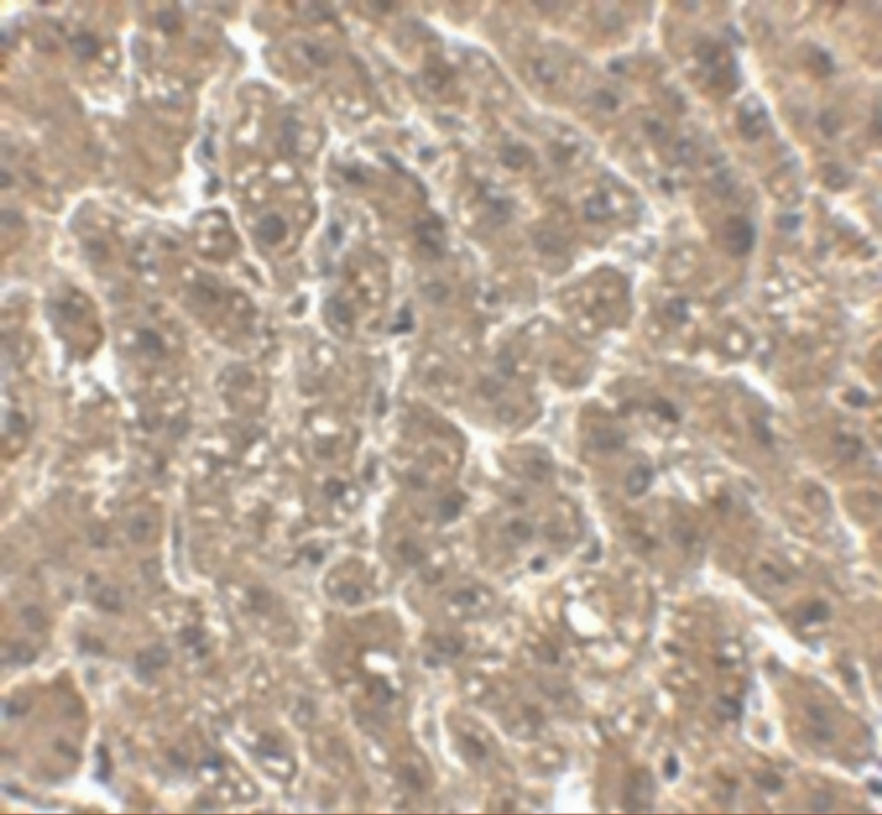 Immunohistochemistry of erbB-2 in human liver tissue with erbB-2 antibody at 2.5 ug/mL.