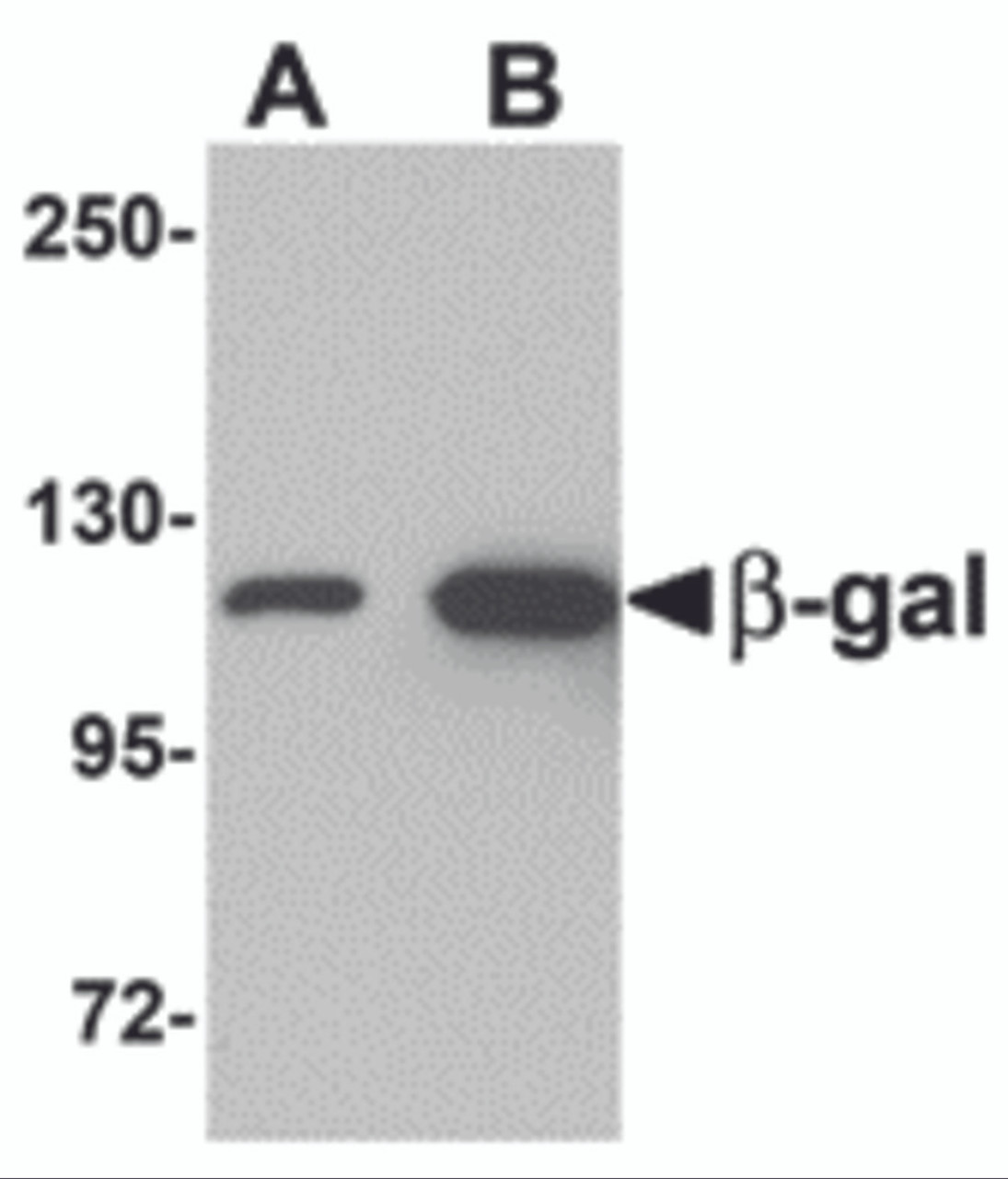 Western blot analysis of (A) 5 and (B) 25 ng of b-gal with b-gal antibody at 1 &#956;g/mL.