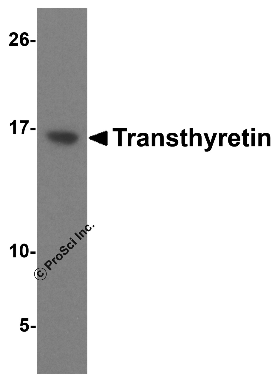 Western blot analysis of 125 ng of Transthyretin recombinant protein with Transthyretin antibody at 1 &#956;g/mL.
