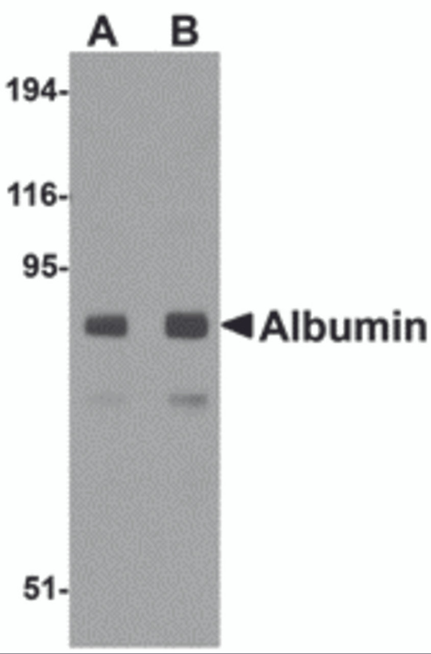 Western blot analysis of Albumin in mouse liver tissue lysate with Albumin antibody at (A) 1 and (B) 2 &#956;g/mL.