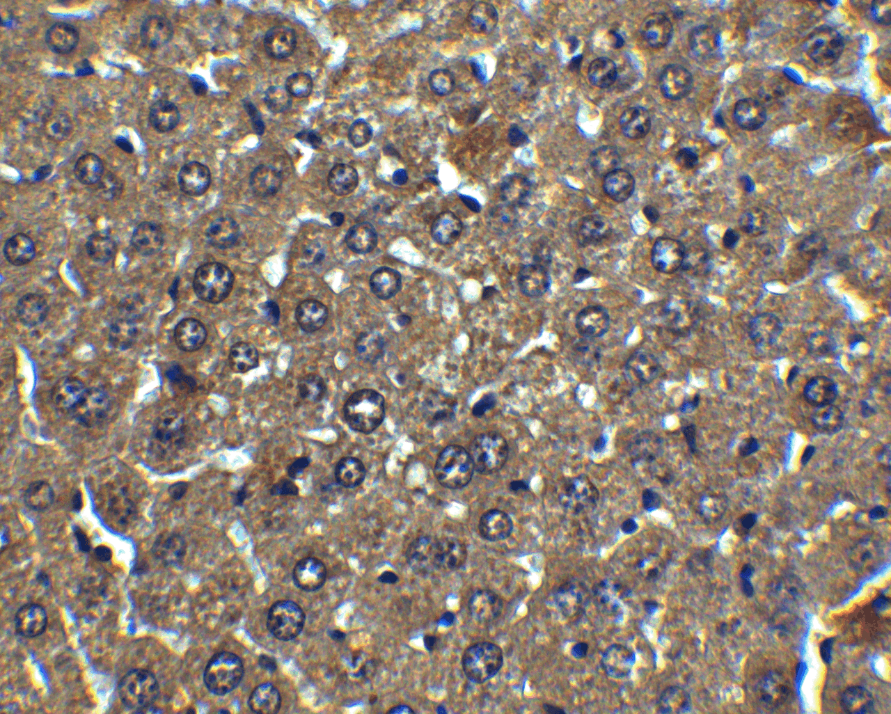 Immunohistochemistry of Albumin in mouse liver tissue with Albumin antibody at 5 ug/mL.