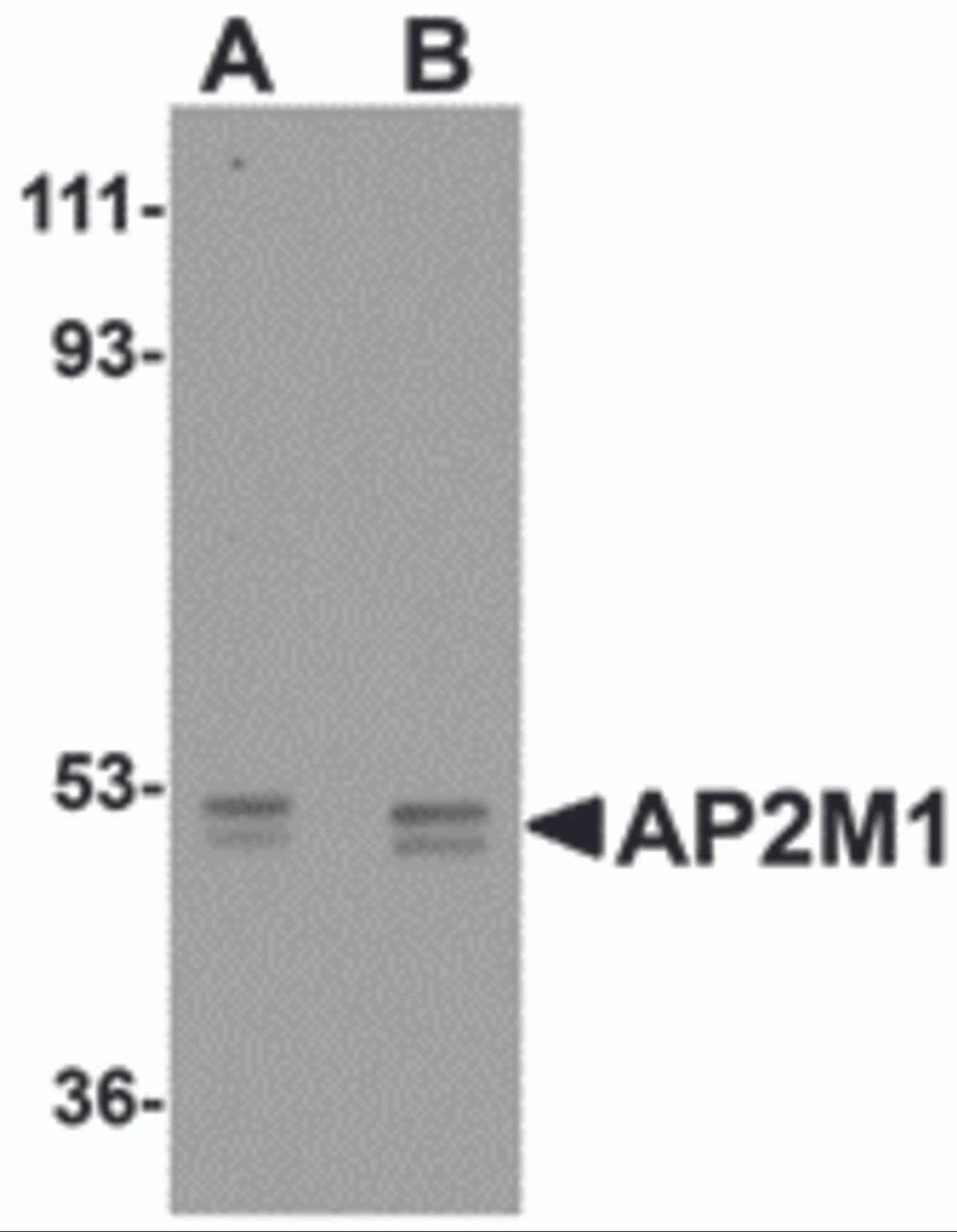 Western blot analysis of AP2M1 in human kidney tissue lysate with AP2M1 antibody at (A) 1 and (B) 2 &#956;g/mL.