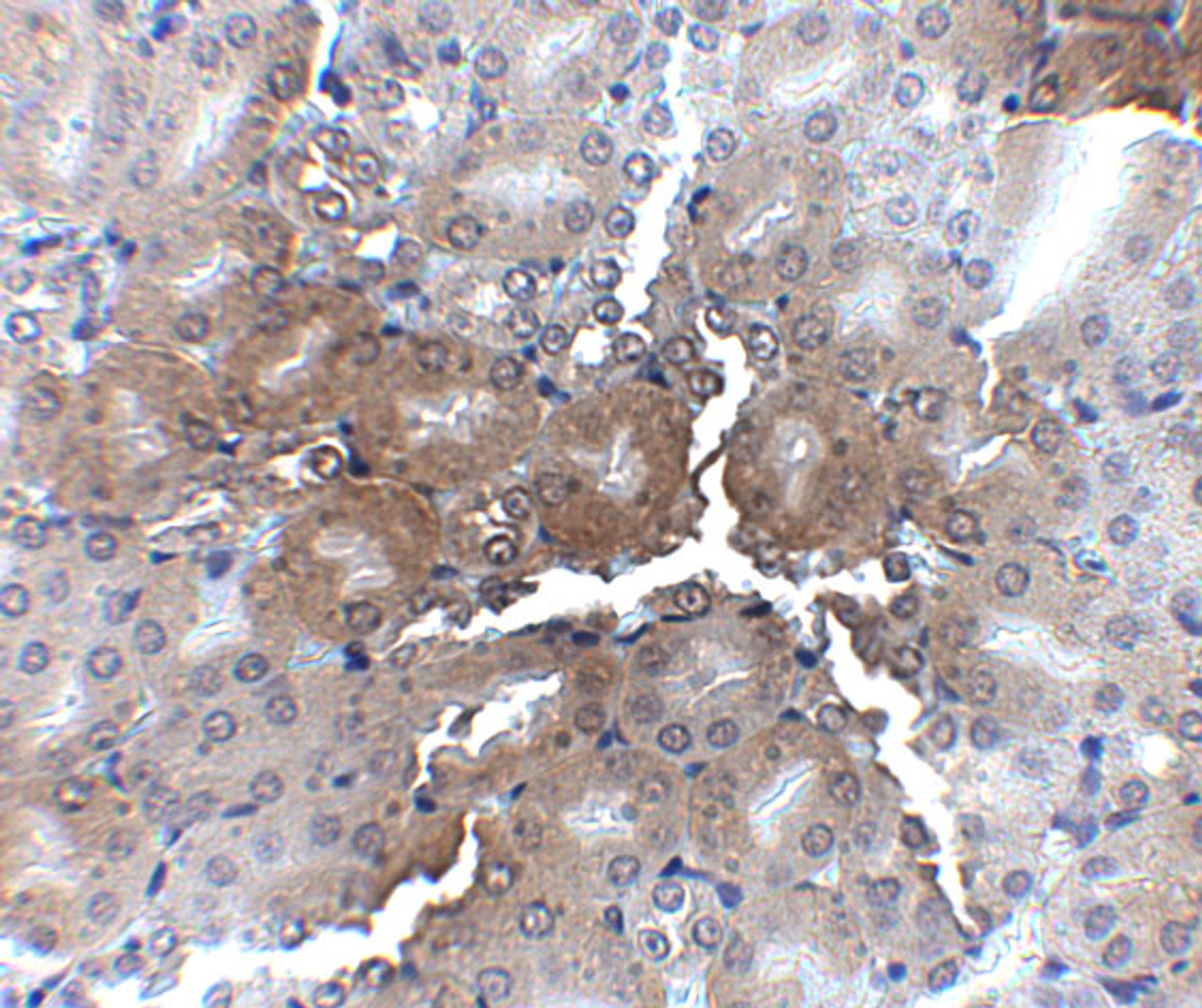 Immunohistochemistry of AP2M1 in mouse kidney tissue with AP2M1 antibody at 2.5 ug/mL.