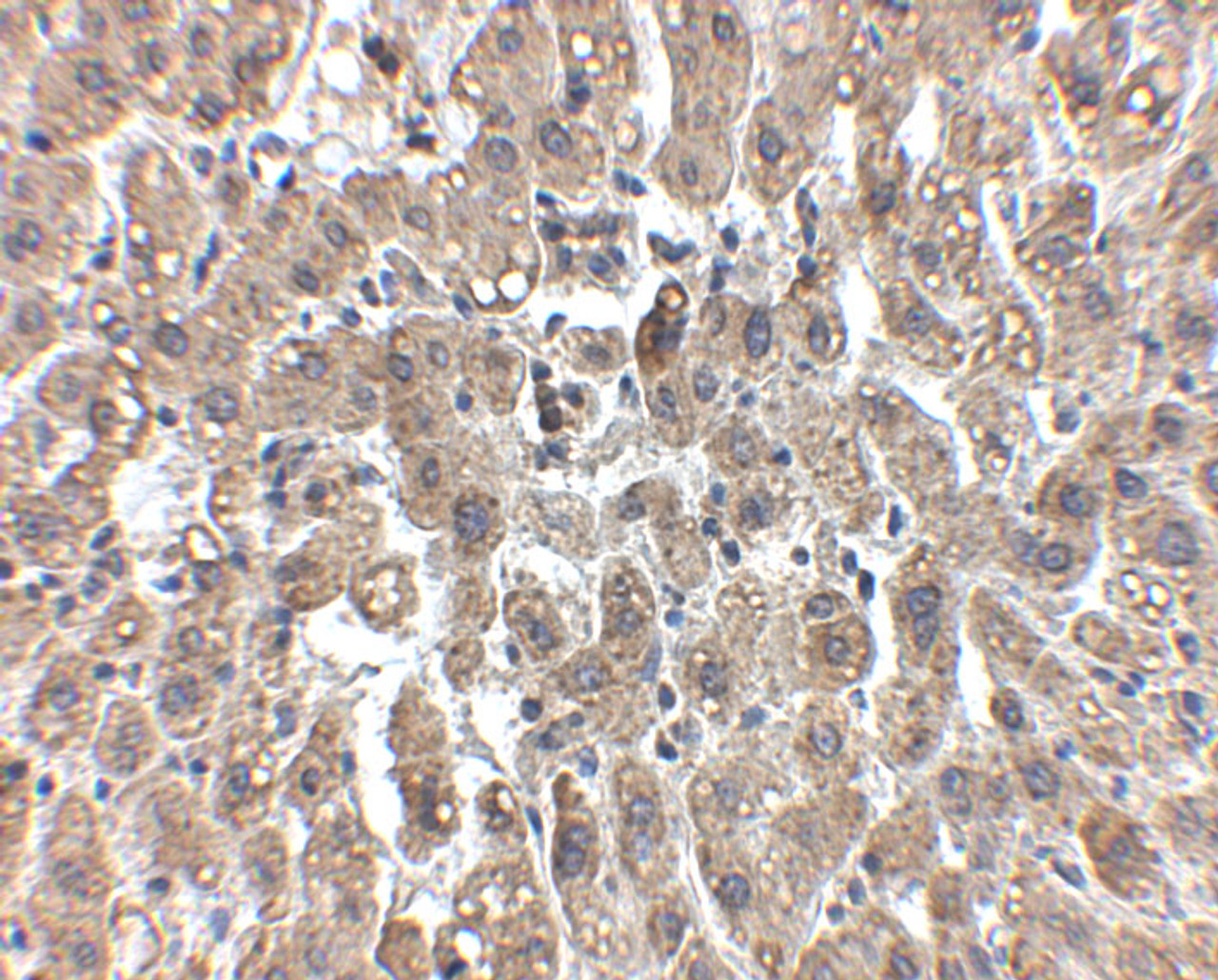Immunohistochemistry of LDL-R in human liver tissue with LDL-R antibody at 2.5 ug/mL.