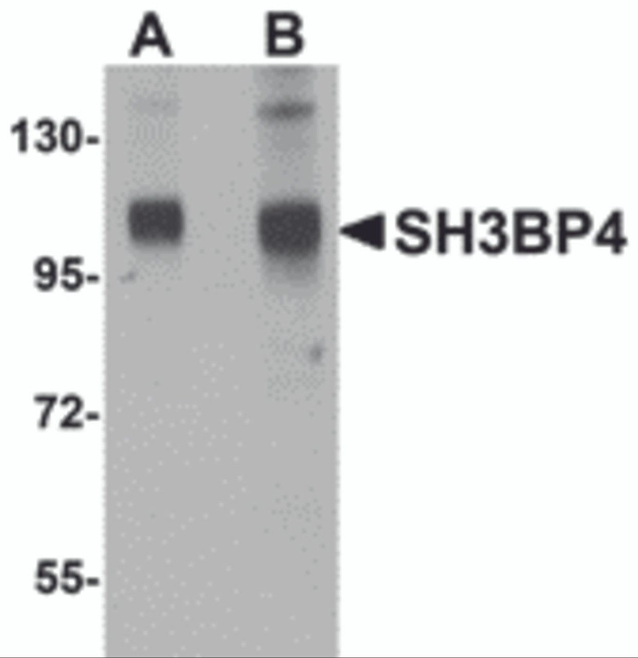 Western blot analysis of SH3BP4 in rat lung tissue lysate with SH3BP4 antibody at (A) 1 and (B) 2 &#956;g/mL.