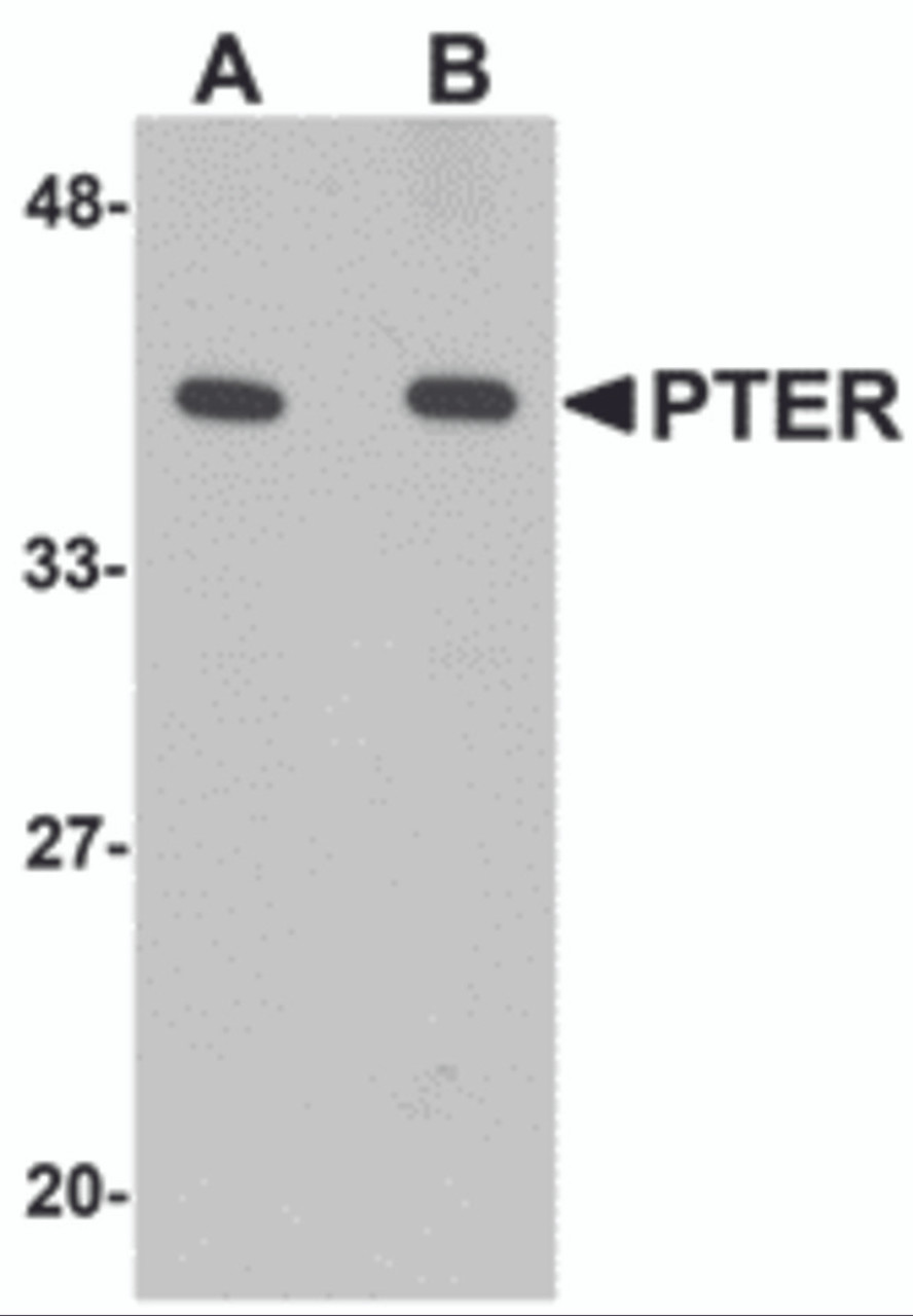 Western blot analysis of PTER in human kidney tissue lysate with PTER antibody at (A) 1 and (B) 2 &#956;g/mL.