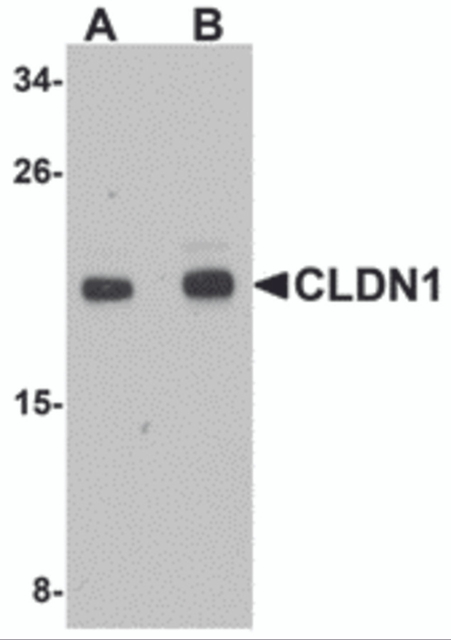 Figure 2 Western Blot Validation in Human HepG2 Cell Lysate
Loading: 15 ug of lysates per lane.
Antibodies: CLDN1, 5187 (A: 1 ug/mL and B: 2 ug/mL) , 1h incubation at RT in 5% NFDM/TBST.
Secondary: Goat anti-rabbit IgG HRP conjugate at 1:10000 dilution.